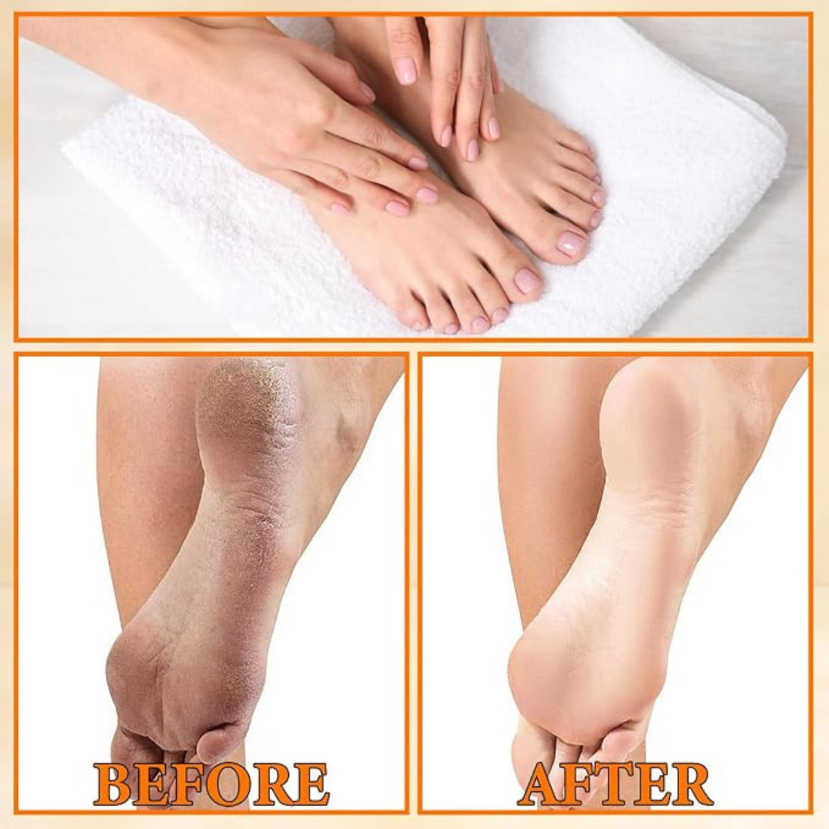 Foot Peeling Spray