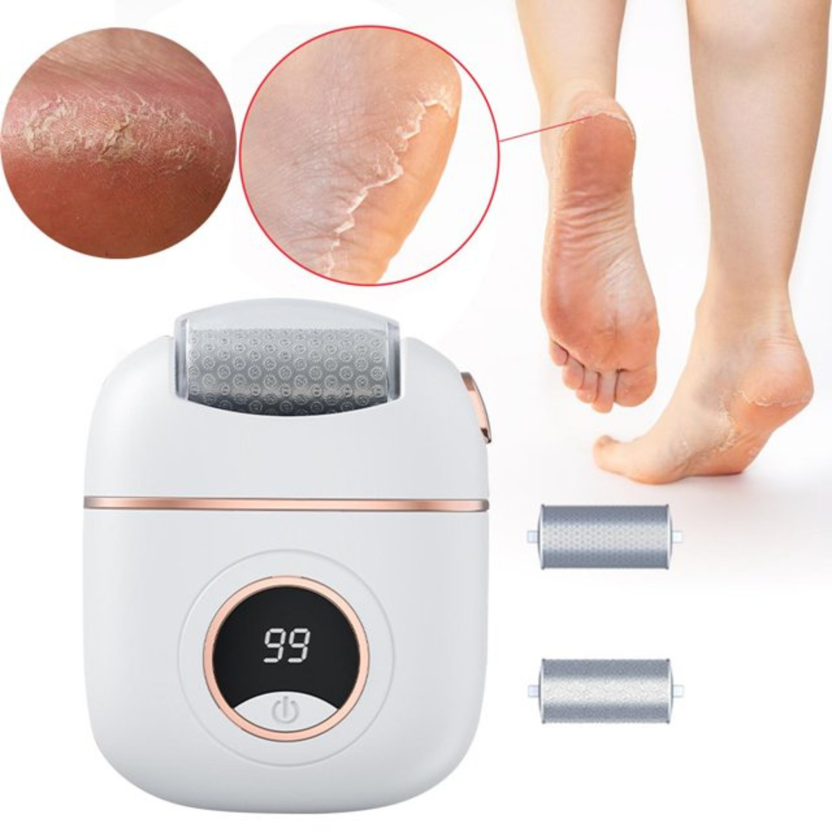 Foot Callus Remover