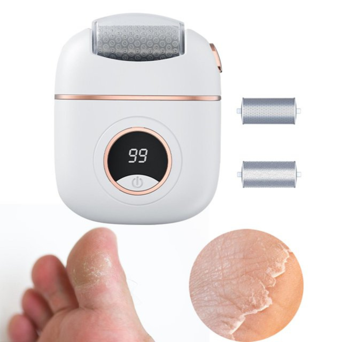Foot Callus Remover